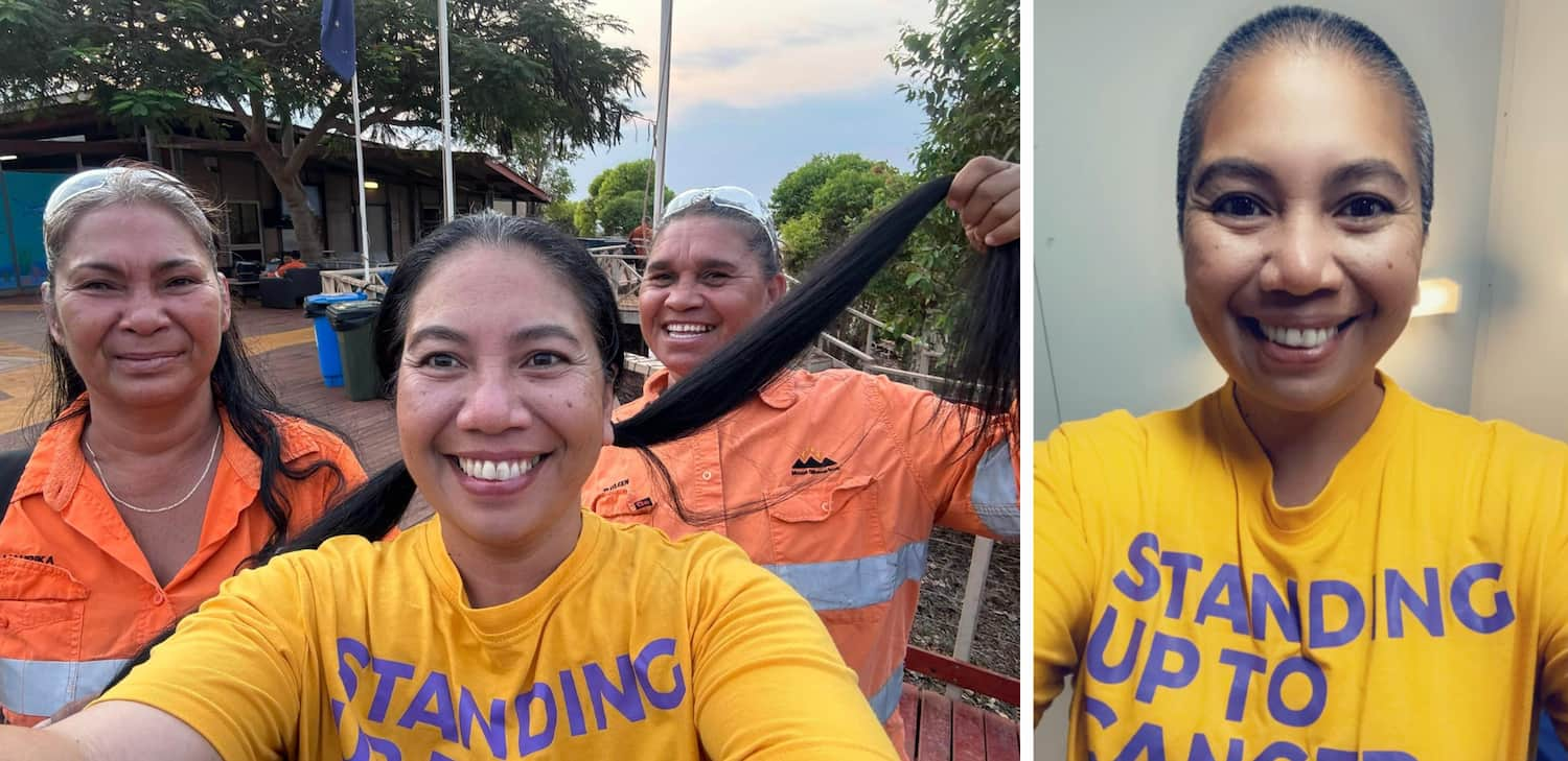 before and after alicia shaved her head for bandanna day